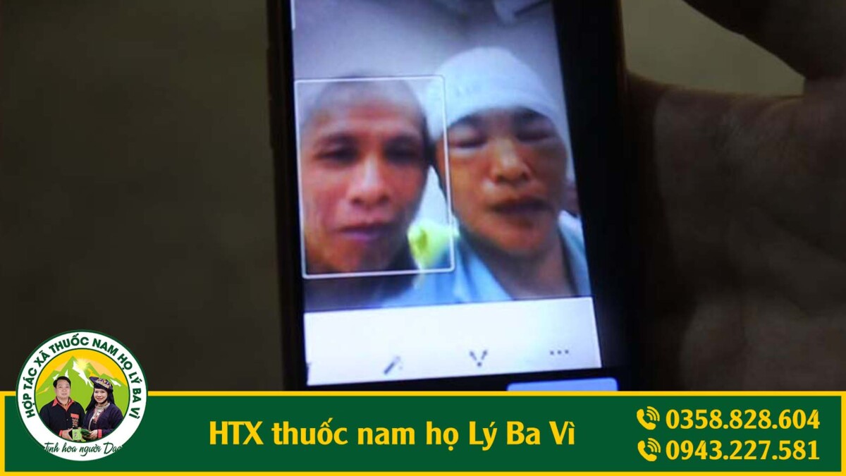 khối u