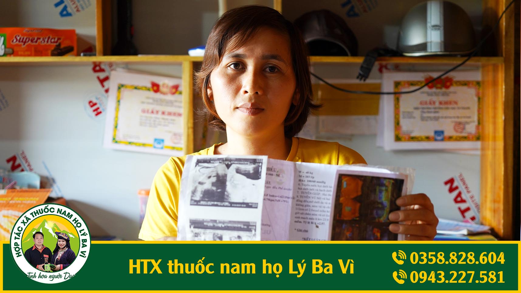 ung-thu-vu