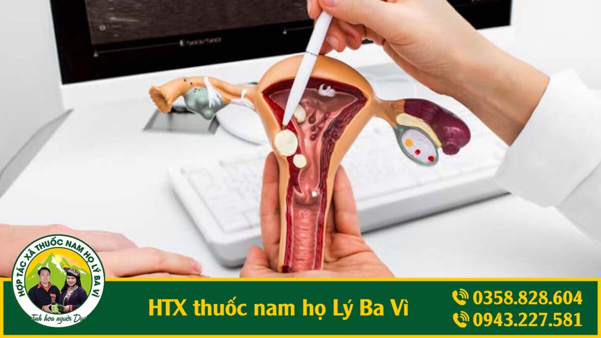 ung thư