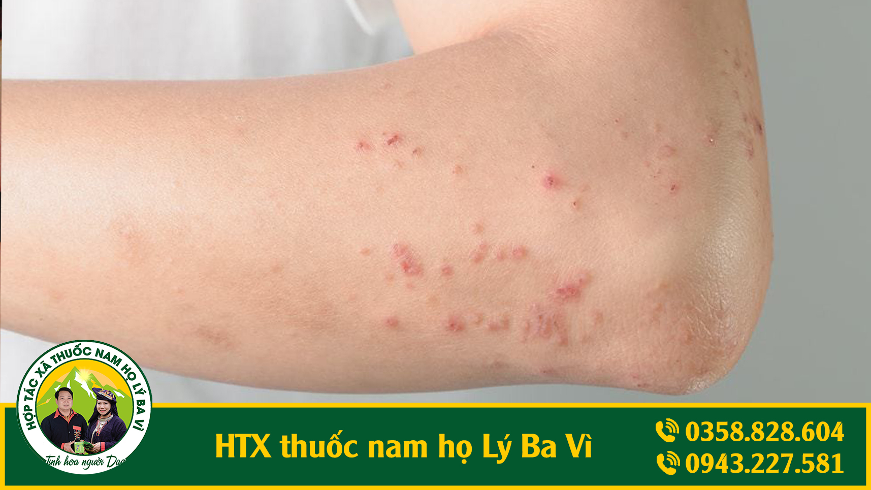 luong_y_ly_sinh_phuc