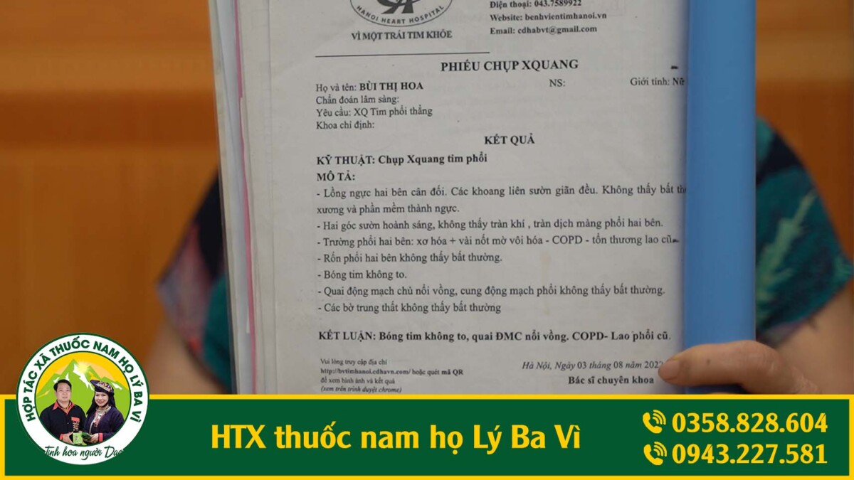 thuốc nam