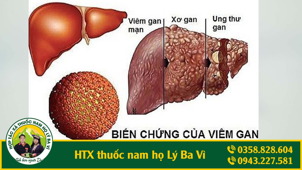 gan