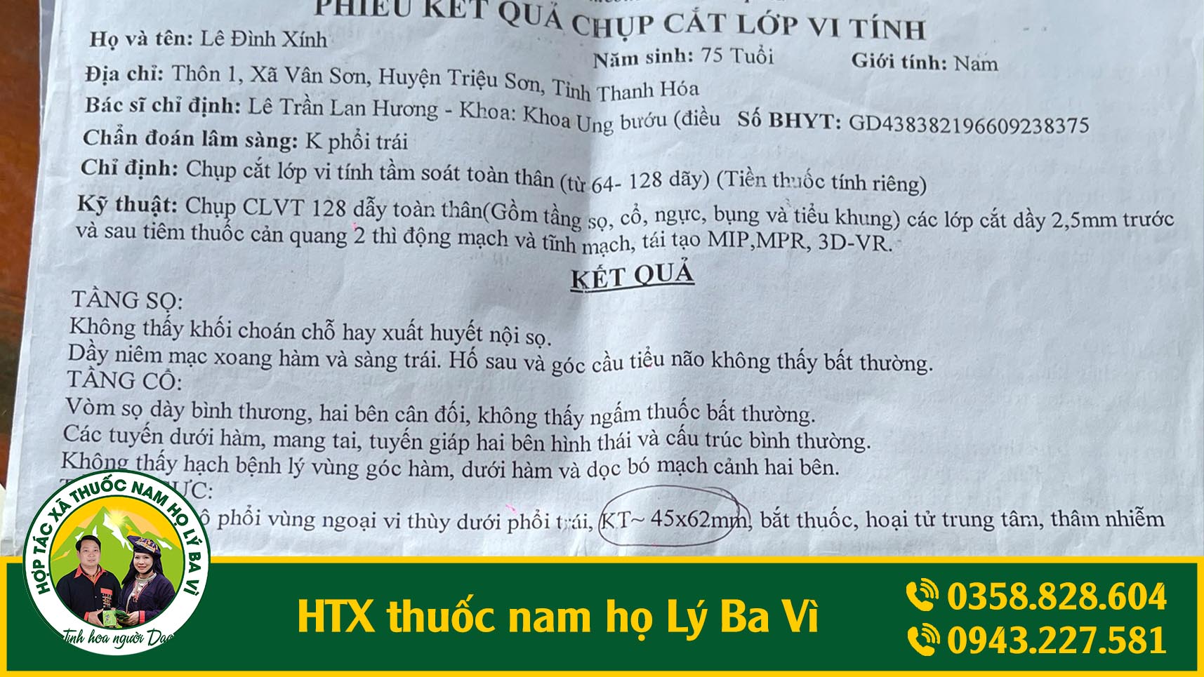 phổi