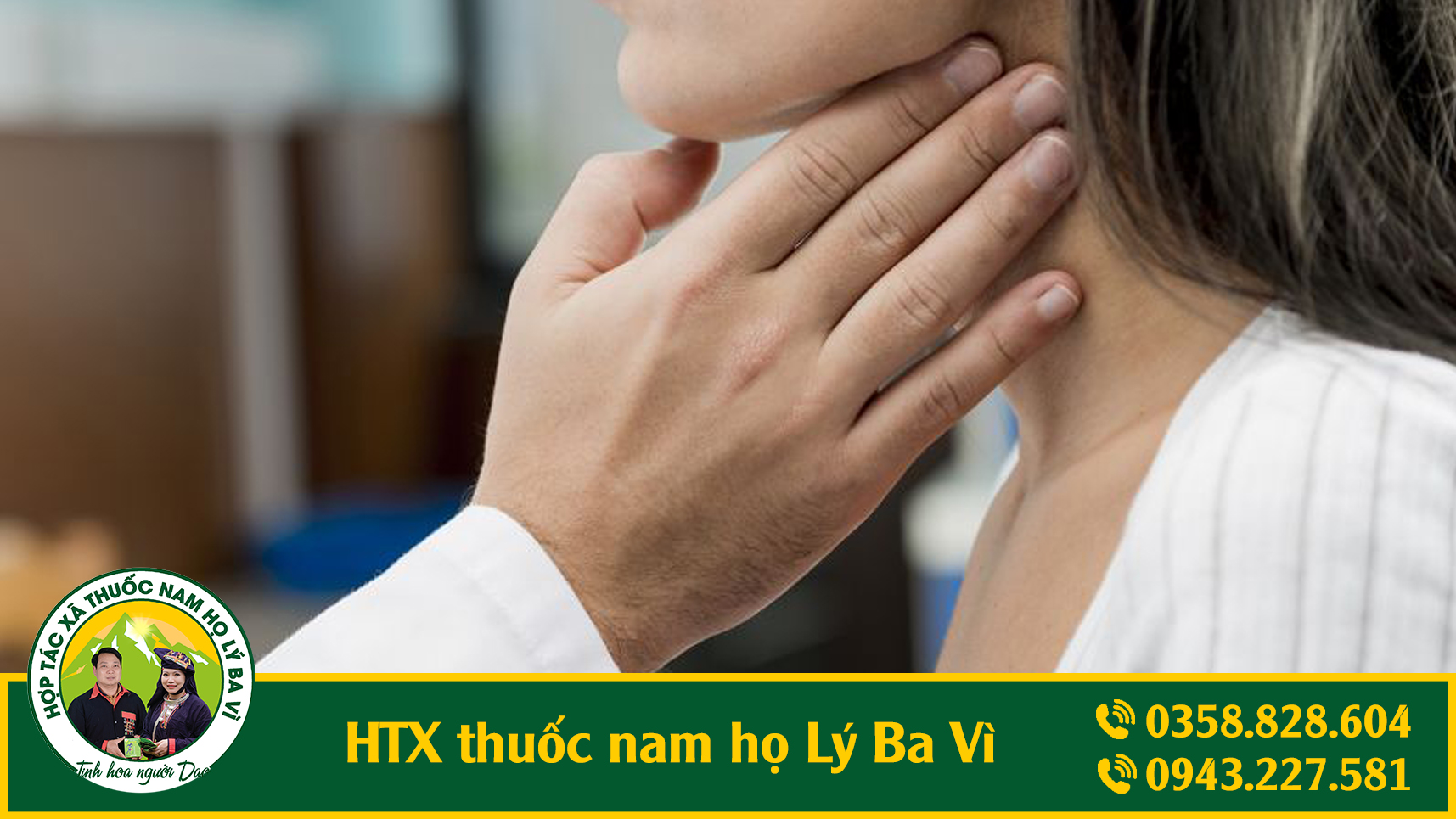 ung_thu_hach_htx_thuoc_nam_ho_ly_ba_vi_1