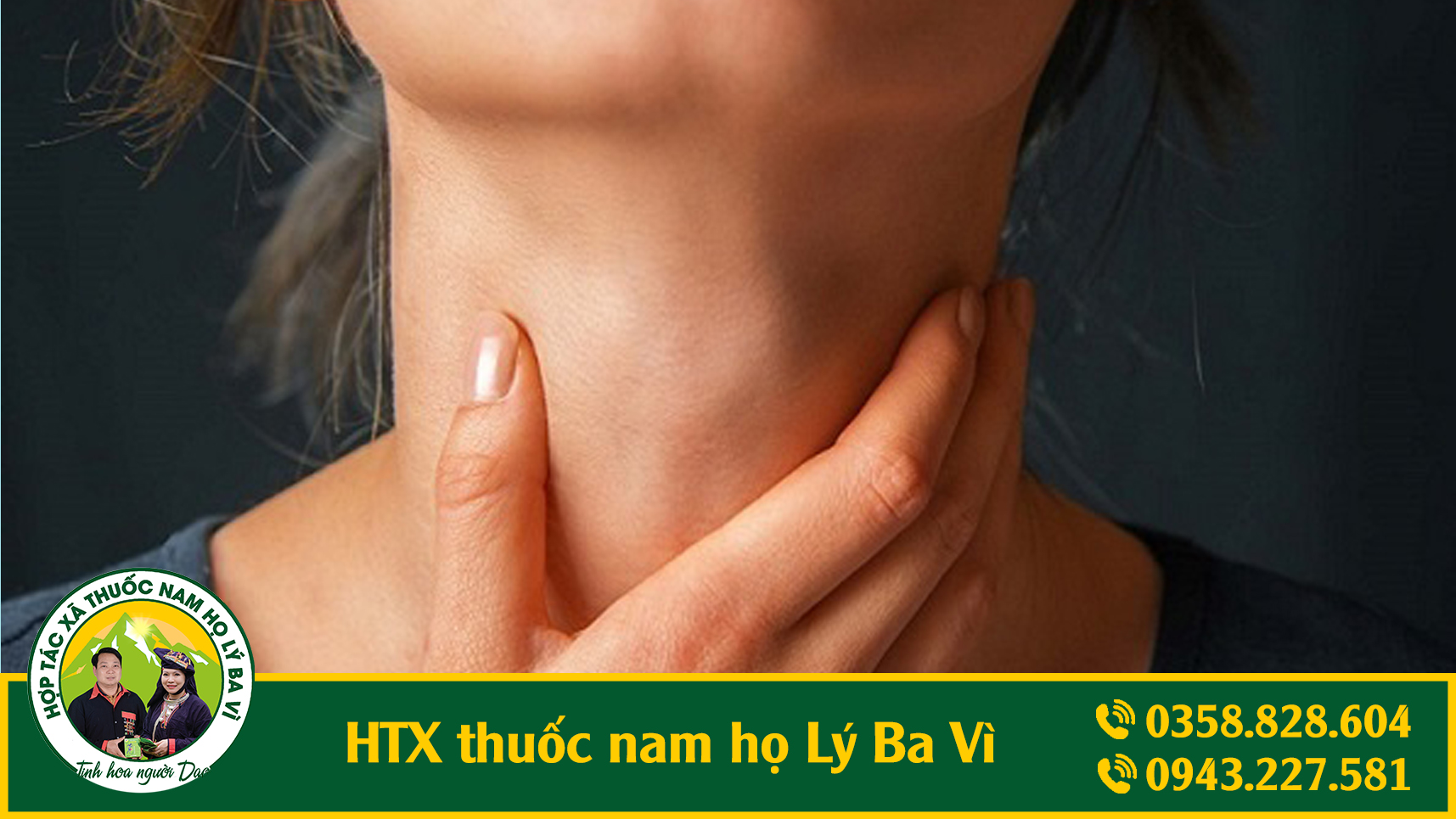 ung_thu_hach_htx_thuoc_nam_ho_ly_ba_vi_1