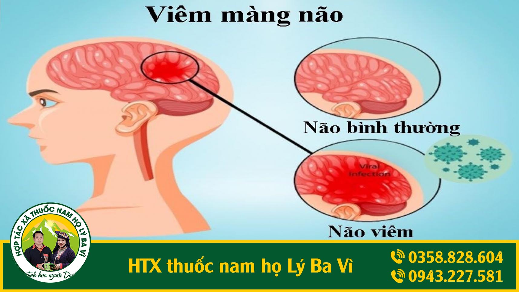 viem-mang-nao